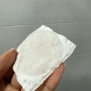 후우 | 내돈내산 기미 주근깨 레이저 루비레이저 일산 피부과 일주일 후기 / 관리방법