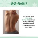 슈퍼맨휘트니스 | 죽전동헬스장 위너휘트니스에서 굽은 등 교정하기