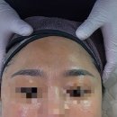 메디스킨유리하