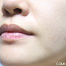 아임케어 이미지