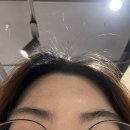 다래한의원 | 다래끼 만성 재발자의 광명찾기여정 .. (수면마취를 위한 대모험 12/12~2/9일까지)