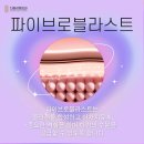 샤인멍 이미지
