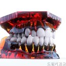 드림치과교정과치과의원 네이버블로그
