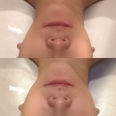 한화금융센터-서초 | ［ 서초 / 교대 ] 교대역 피부관리 바오뜨 에스테틱 원모드 리프팅 받은 후기 얼굴라인 정리 관리