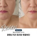 소랑 토탈케어 뷰티 | 광명사거리 마리장토탈뷰티 작은얼굴 윤곽케어 후기