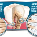 상아플란트치과 이미지
