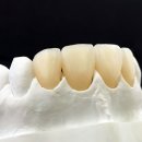 터치과기공소 이미지