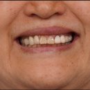 덴티움기공소 이미지