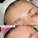 피아블레왁싱 이미지