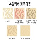 서현5층약국 | 분당 서현역 주블링&amp;스킨52 튼살커버 후기(내돈내산💸)