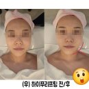 평택 수기관리, 비전동 소사벌 피부관리 진스킨앤바디 방문 후기