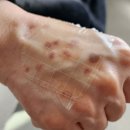 헤아린피부과의원 이미지