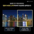 후 | 렌즈삽입술 후기 정리 후 선택