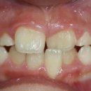 이(e)-밝은치과의원 이미지