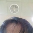 제일안과 Daum카페