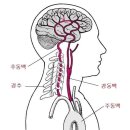 뇌혈관질환 예방 이미지