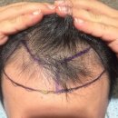 뉴헤어모발성형외과의원 이미지