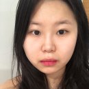 진여워터테라피 재방문 페이스워터테라피관리 받은 후기