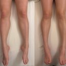 와우테크닉 | 에스테틱 [ 선에스테스파 ] 얼굴 윤곽 퍼스널윤곽과 빼빼바디 하체관리 후기 1회만 받아도 체지방량 -1.7