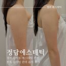 청주 슬리밍 바본관리 ‘정담에스테틱’ 팔뚝 슬리밍 1회차 후기
