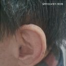 딜라이트보청기 | 대신동보청기 딜라이트보청기 대신점 보청기 잘하는곳