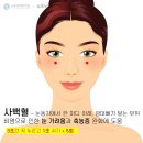 창동경희한의원 네이버블로그