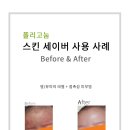 키박 이미지