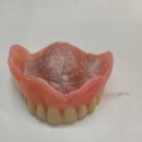 다윗치과기공소 네이버블로그