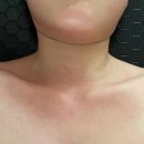 바디웨이브파동테라피 이미지