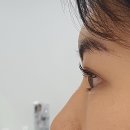 사하구-37 | 부산사하구눈썹 괴정속눈썹 린케이 사하점 클리닉펌 후기
