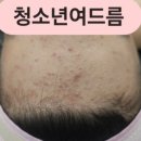 스무살에머물다 이미지