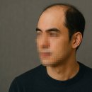 시몬 주변 | 부천 시몬가발 정수리 부분가발 착용 후기, 티 안나는 자연스러움 최고!