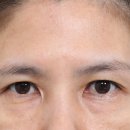 초이성형외과