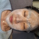 서면편평사마귀제거 한의원 깔끔한 피부 만든 솔직후기