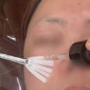 경산 옥산동 유라인에스테틱, 유라인에스테틱 눈밑처짐관리후기, 유라인에스테틱모공관리후기.
