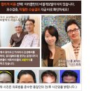 현헤어라인 이미지