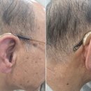 스타키보청기 안동점 이미지