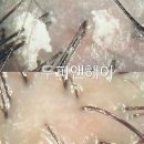 거창유치원 | 샴푸로 해결 안 되는 두피각질 전문 관리는? 거창 함양 합천 두피탈모 전문샵- 거창 두피앤헤어 [시크릿...