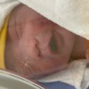 만인요양병원 | 조기출산 | 서울성모병원 • 제왕절개 후기 • 응급제왕 • 고현선 교수님 • 1인실 후기 • 미숙아출산...