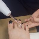 춘천내성발톱 패디젤원컬러 하이푸스 춘천온의점 주차O