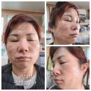 채이은 원팩 2주 사용후기