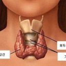 갑상선암 이럴 때 의심해야 이미지