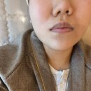 1389 | 천안 청당동피부관리 좁쌀여드름압출 산소에너지케어 후기 차올에스테틱