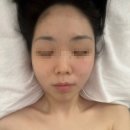 이마트24 영등포점 | 무이에스테틱 영등포 신도림점 | 무이 소프트 윤곽 내돈내산 찐후기 | 영등포 웨딩관리 맛집