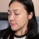 리쥬란힐러 맞으러 우유빛의원 다녀온 후기 ㅎㅎ