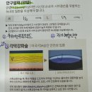 스마일 | 강남ㅂㄹㄷ안과 스마일라식 후기