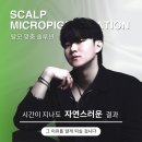 강동-천호-2473 | 천호smp 탈모 고민 끝낸 리얼 후기와 통증,부작용 총정리