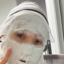 영플러스 | 올리브영 피지연화제 메디필 슈퍼9 플러스 3X 전후 후기 (올리브영 오늘픽업)