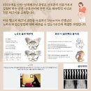 카이로프락틱 이미지
