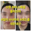 화서역 뷰디스페셜 내돈내산 잡티제거 플라즈마 후기